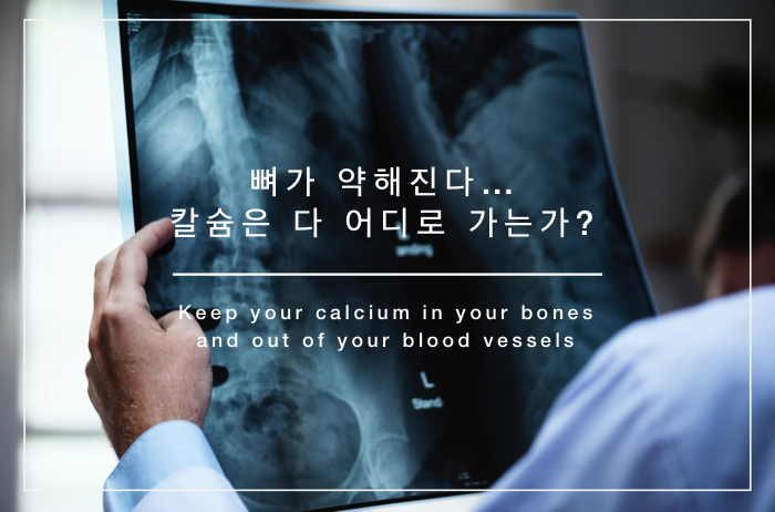 You are currently viewing 뼈가 약해진다…칼슘은 다 어디로 가는가?