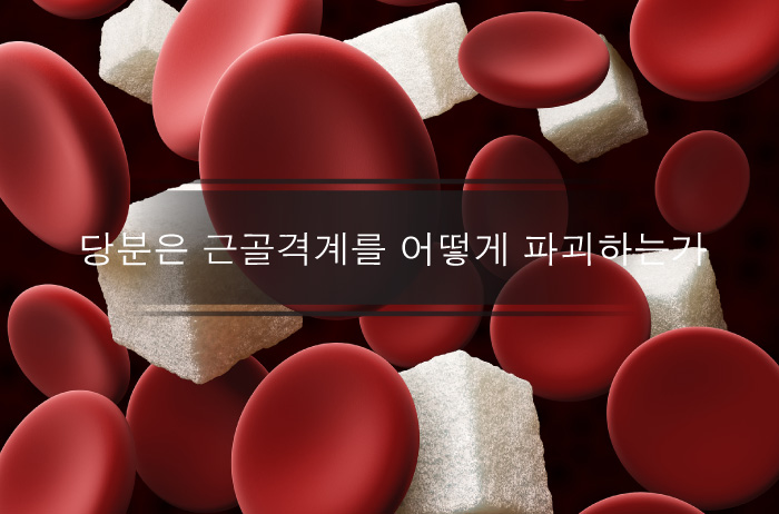 Read more about the article 혈당 조절 불량은 근골격계를 어떻게 파괴시키는가